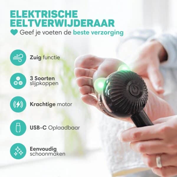Velvet Touch - elektrische eeltverwijderaar pro