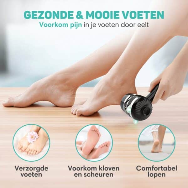 Velvet Touch - elektrische eeltverwijderaar pro