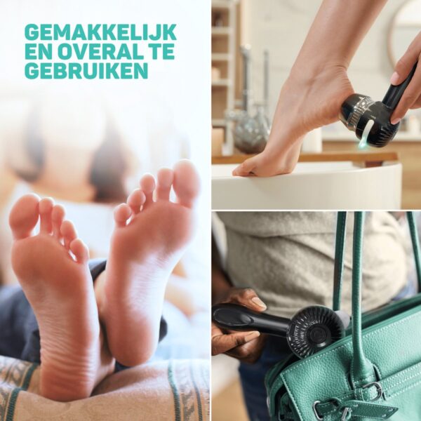 Velvet Touch - elektrische eeltverwijderaar pro